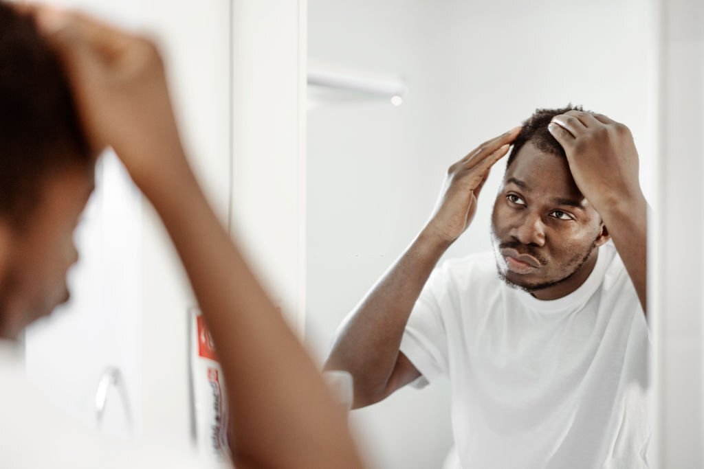 How To Stop and Reverse Hair Loss/ Receding Hairline