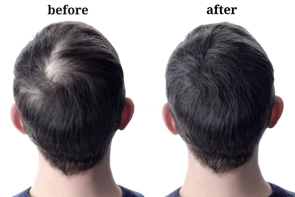 What You Need To Know About Hair Fibers ( Advantages & Disadvantages)