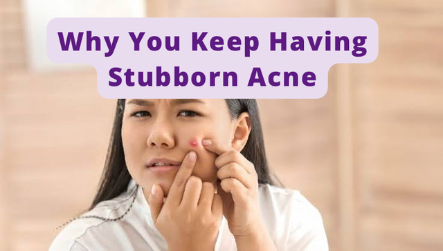 Why You Keep Having Stubborn Acne