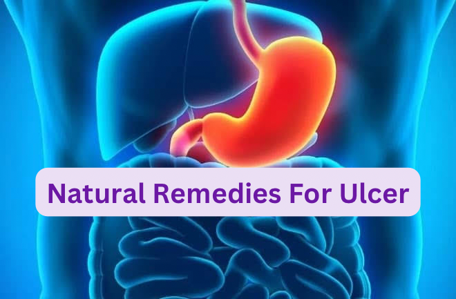 Natural Remedies For Ulcer
