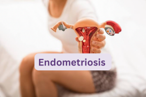 Signs You May Be Suffering From Endometriosis