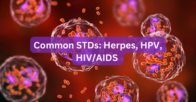 Common STDs: herpes, HPV, HIV/AIDS