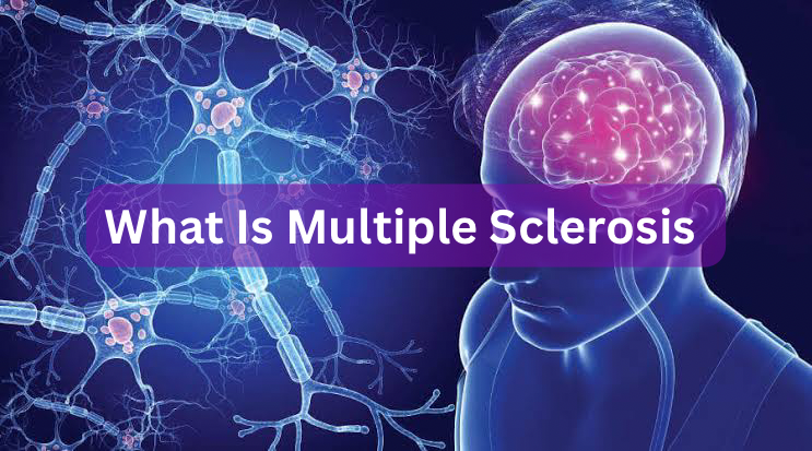 What is Multiple sclerosis