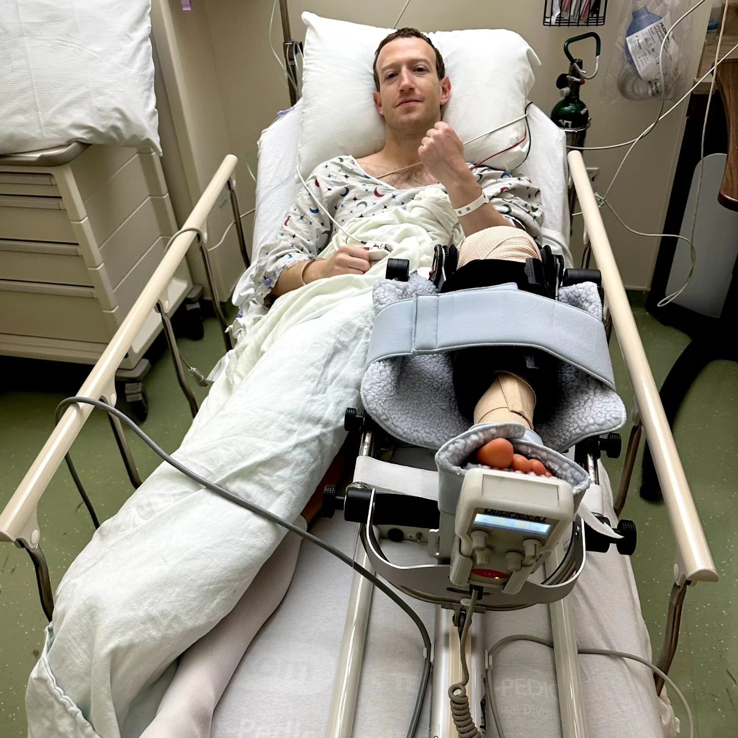 Facebook CEO, Mark Zuckerberg Gets Injured While Sparring In a MMA Fight