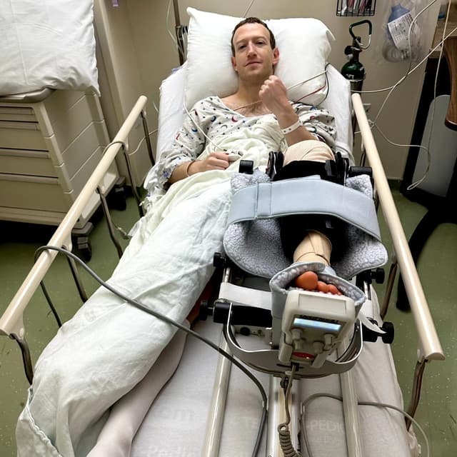 Facebook CEO, Mark Zuckerberg Gets Injured While Sparring In a MMA Fight