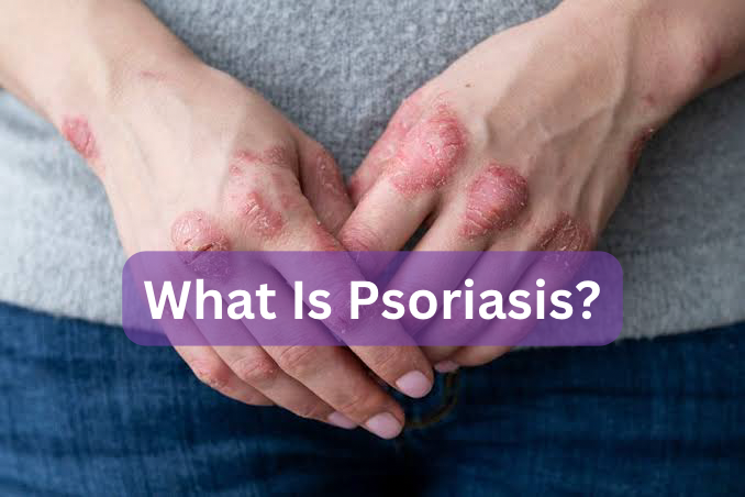 Psoriasis; Symptoms And Causes