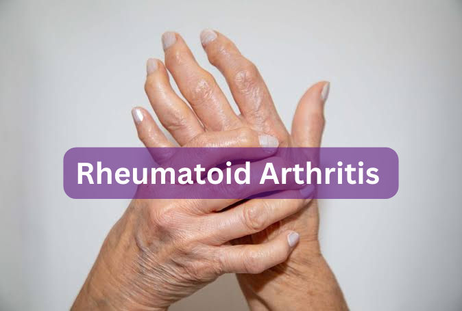 Comprehensive Understanding of Rheumatoid Arthritis (RA)