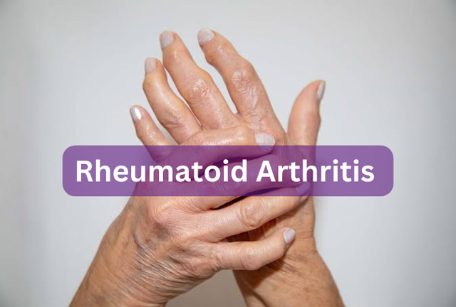Comprehensive Understanding of Rheumatoid Arthritis (RA)